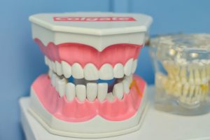 dental implant
